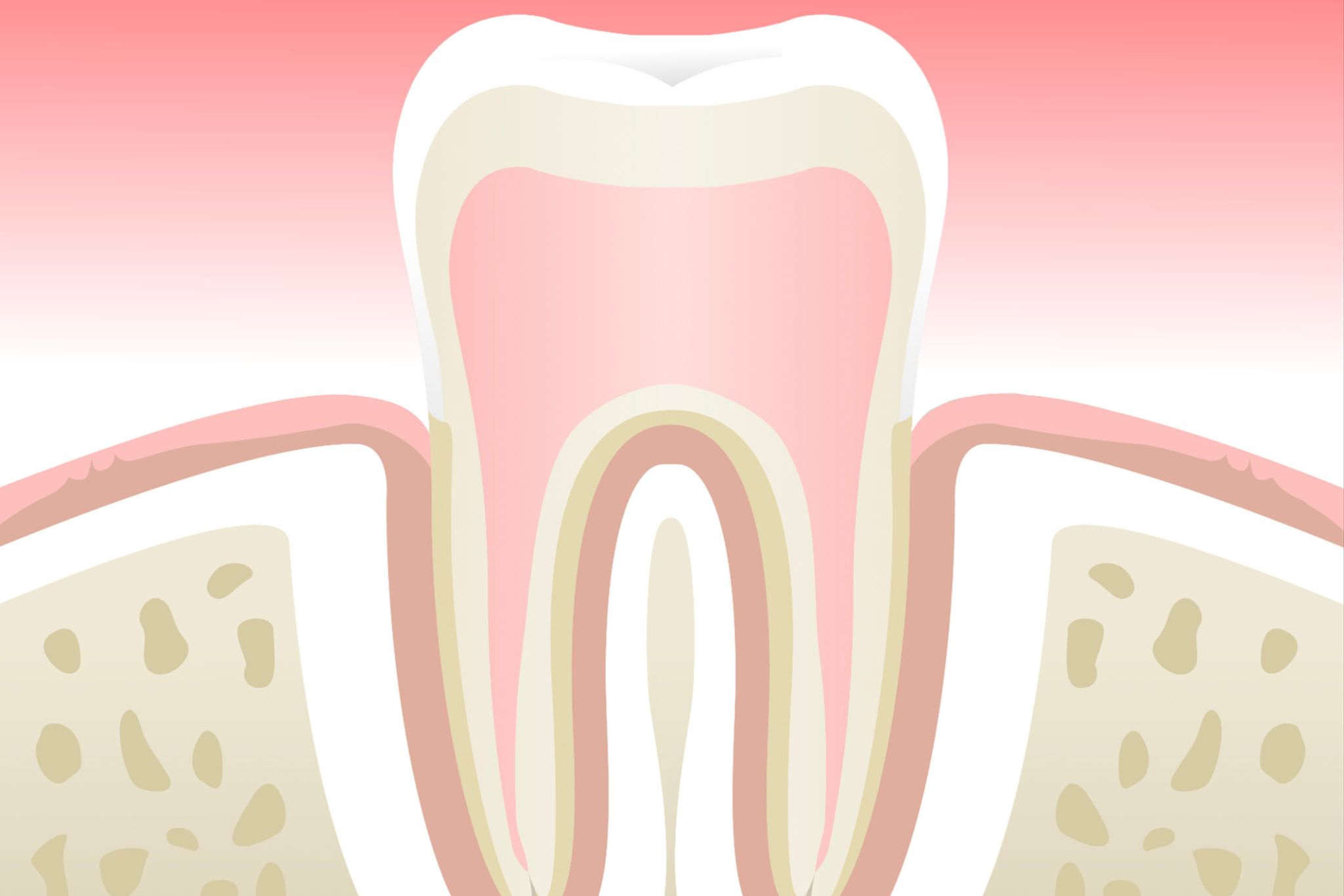 parodontite-stade-1-dentiste-marseille